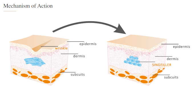 Dermal Filler Procedures