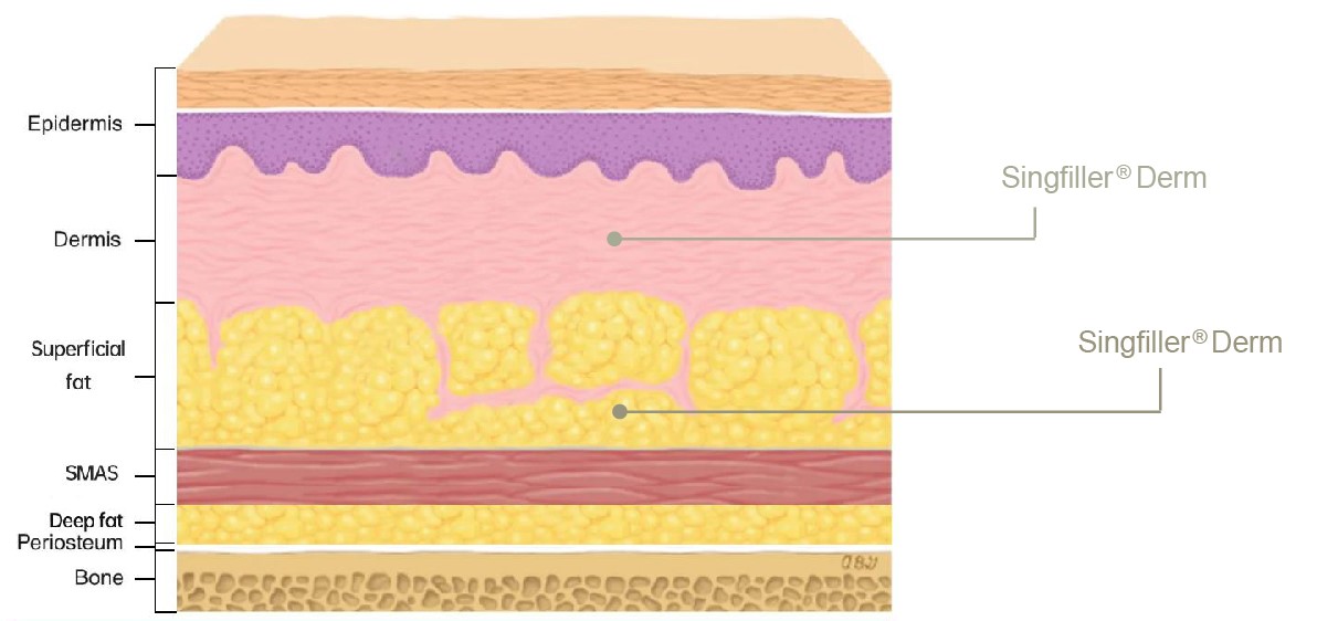 singfiller derm